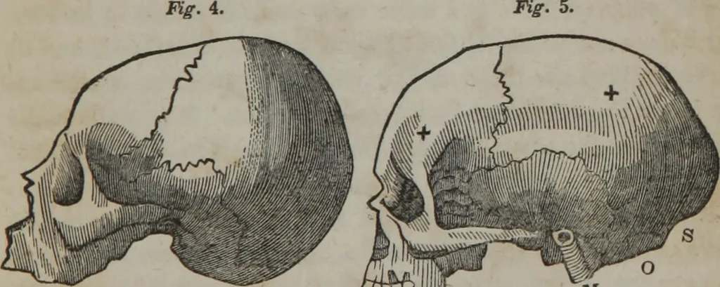An illustration from A defence of phrenology, 1847, leaf 166