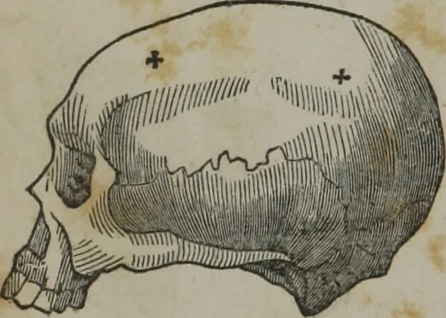 An illustration from A defence of phrenology, 1847, leaf 167