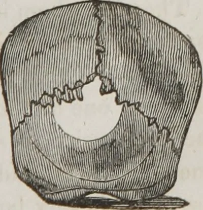 An illustration from Lectures on phrenology : including its application to the present and prospective condition of the United States, 1839, leaf 154