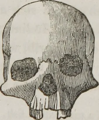 An illustration from Lectures on phrenology : including its application to the present and prospective condition of the United States, 1839, leaf 160