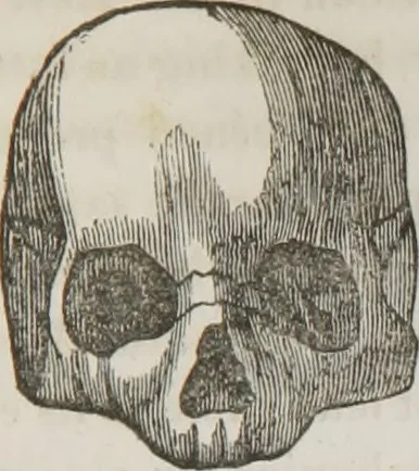 An illustration from Lectures on phrenology : including its application to the present and prospective condition of the United States, 1839, leaf 180
