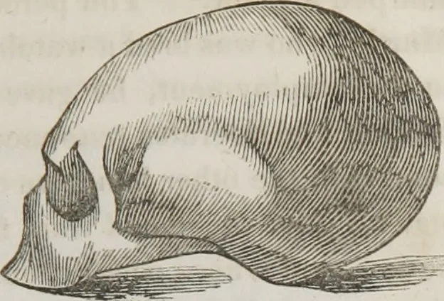 An illustration from Lectures on phrenology : including its application to the present and prospective condition of the United States, 1839, leaf 180