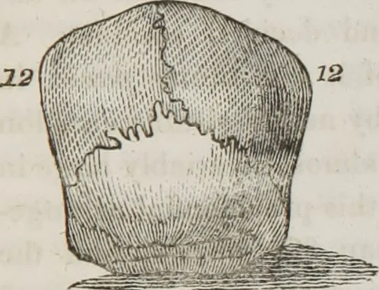 An illustration from Lectures on phrenology : including its application to the present and prospective condition of the United States, 1839, leaf 192