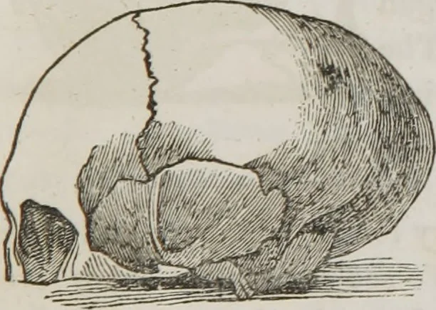 An illustration from Lectures on phrenology : including its application to the present and prospective condition of the United States, 1839, leaf 34