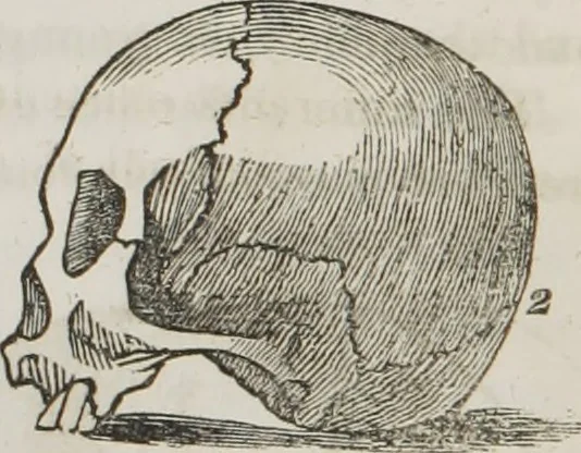 An illustration from Lectures on phrenology : including its application to the present and prospective condition of the United States, 1839, leaf 35