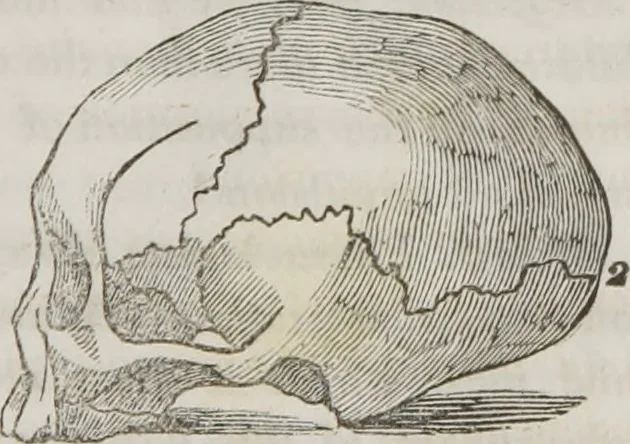 An illustration from Lectures on phrenology : including its application to the present and prospective condition of the United States, 1839, leaf 42