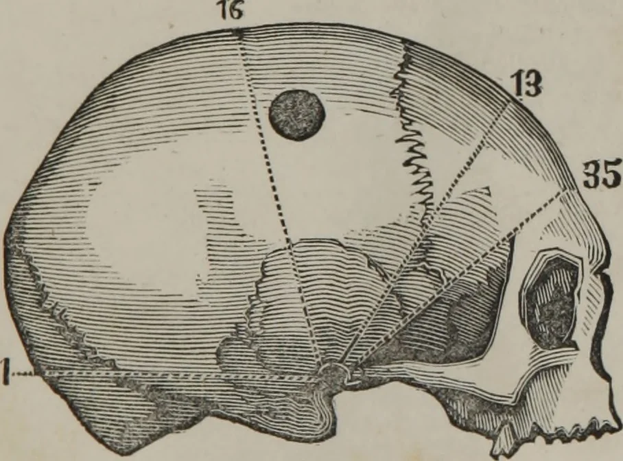 An illustration from Coombs's standard phrenology : exhibiting the exact phrenological admeasurements of above fifty distinguished and extraordinary personages, of both sexes : with skulls of the various nations of the world : embellished with above 50 engravings, and poetical descriptions of beauty, intellect, and physiognomy : with observations explanatory of the science, adapted to the character of [blank], 1841, leaf 46
