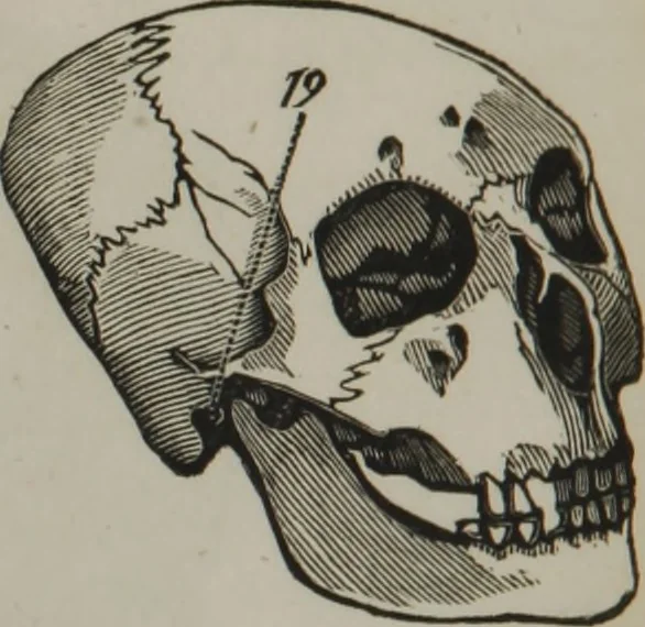 An illustration from Coombs's standard phrenology : exhibiting the exact phrenological admeasurements of above fifty distinguished and extraordinary personages, of both sexes : with skulls of the various nations of the world : embellished with above 50 engravings, and poetical descriptions of beauty, intellect, and physiognomy : with observations explanatory of the science, adapted to the character of [blank], 1841, leaf 61