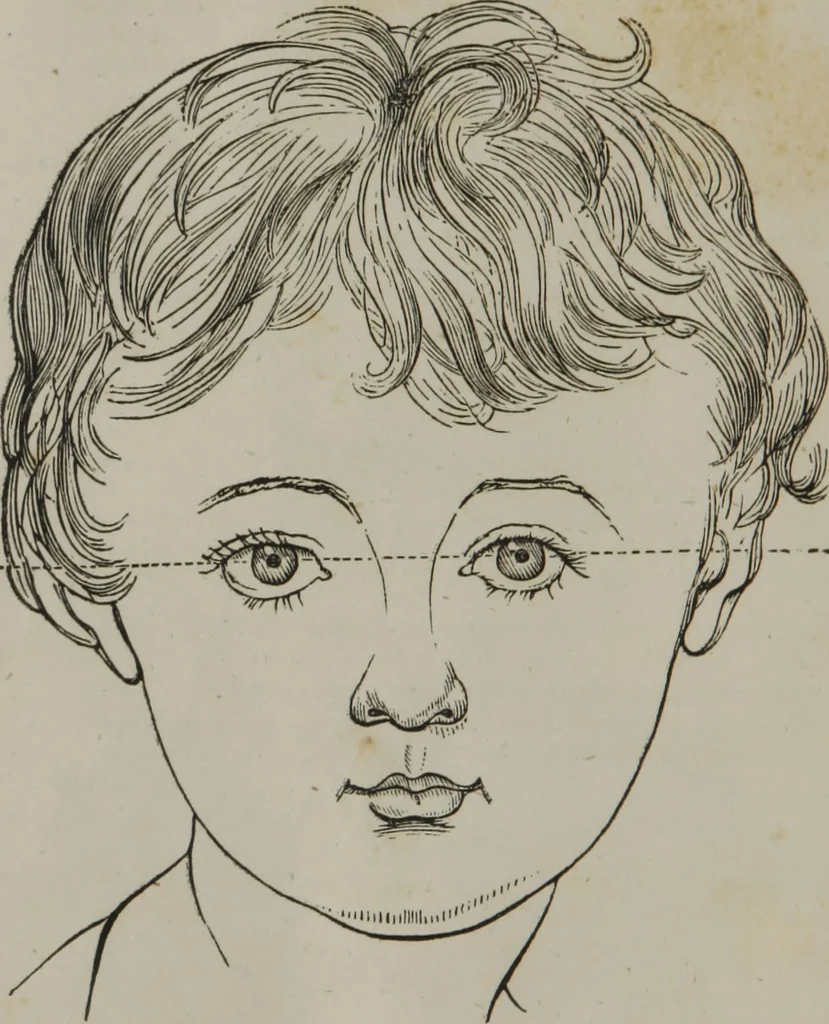 An illustration from Coombs's standard phrenology : exhibiting the exact phrenological admeasurements of above fifty distinguished and extraordinary personages, of both sexes : with skulls of the various nations of the world : embellished with above 50 engravings, and poetical descriptions of beauty, intellect, and physiognomy : with observations explanatory of the science, adapted to the character of [blank], 1841, leaf 67
