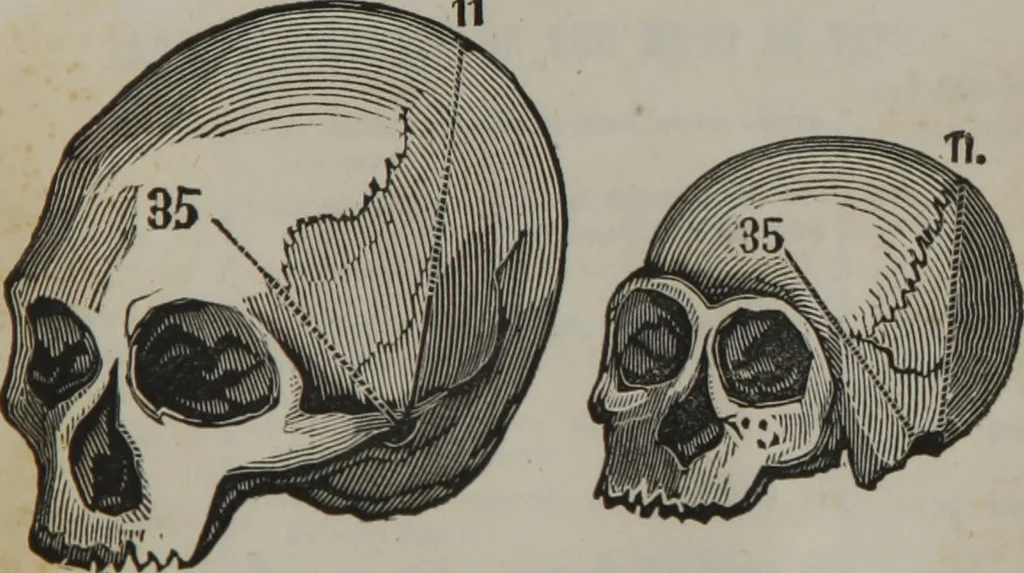 An illustration from Coombs's standard phrenology : exhibiting the exact phrenological admeasurements of above fifty distinguished and extraordinary personages, of both sexes : with skulls of the various nations of the world : embellished with above 50 engravings, and poetical descriptions of beauty, intellect, and physiognomy : with observations explanatory of the science, adapted to the character of [blank], 1841, leaf 82