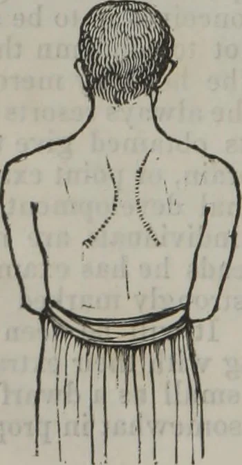 An illustration from Coombs's standard phrenology : exhibiting the exact phrenological admeasurements of above fifty distinguished and extraordinary personages, of both sexes : with skulls of the various nations of the world : embellished with above 50 engravings, and poetical descriptions of beauty, intellect, and physiognomy : with observations explanatory of the science, adapted to the character of [blank], 1841, leaf 9