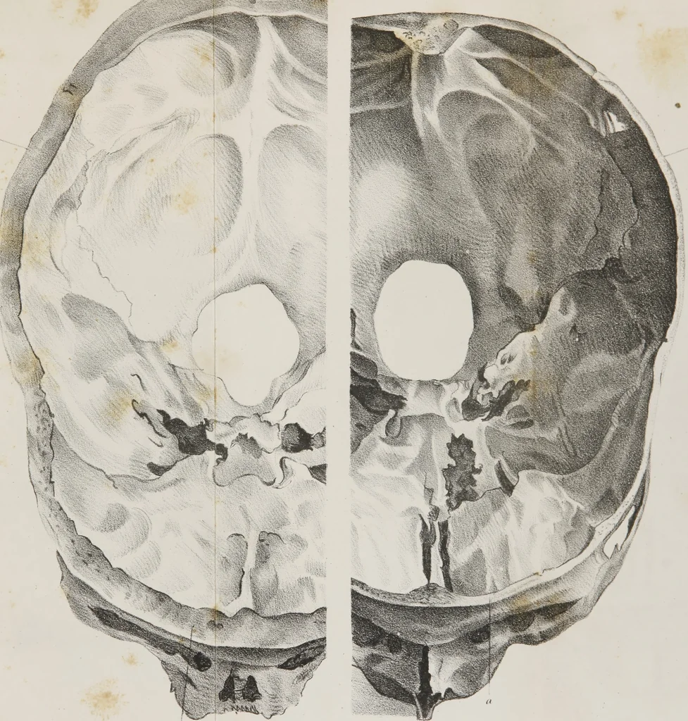 An illustration from An examination of phrenology : in two lectures : delivered to the students of the Columbian College, District of Columbia, February, 1837, 1839, leaf 126