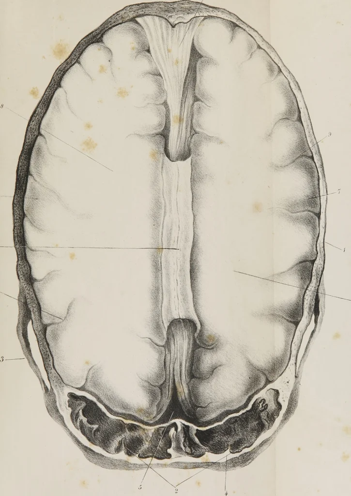 An illustration from An examination of phrenology : in two lectures : delivered to the students of the Columbian College, District of Columbia, February, 1837, 1839, leaf 134
