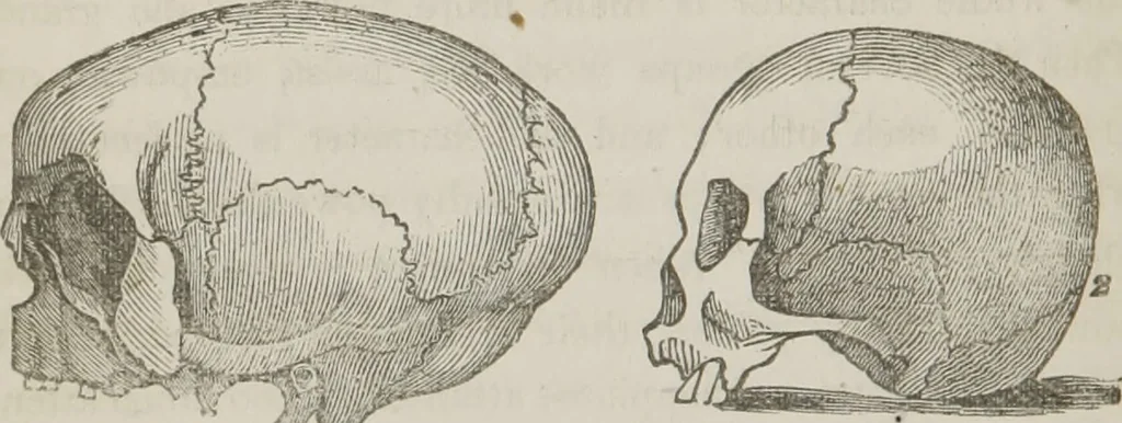 An illustration from Lectures on mental science according to the philosophy of phrenology : delivered before the Anthropological Society of the Western Liberal Institute of Marietta, Ohio, in the autumn of 1851, 1854, leaf 95
