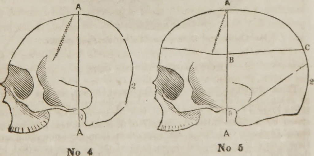 An illustration from Matrimony, or, Phrenology and physiology applied to the selection of congenial companions for life : including directions to the married for living together affectionately and happily, 1851, leaf 24