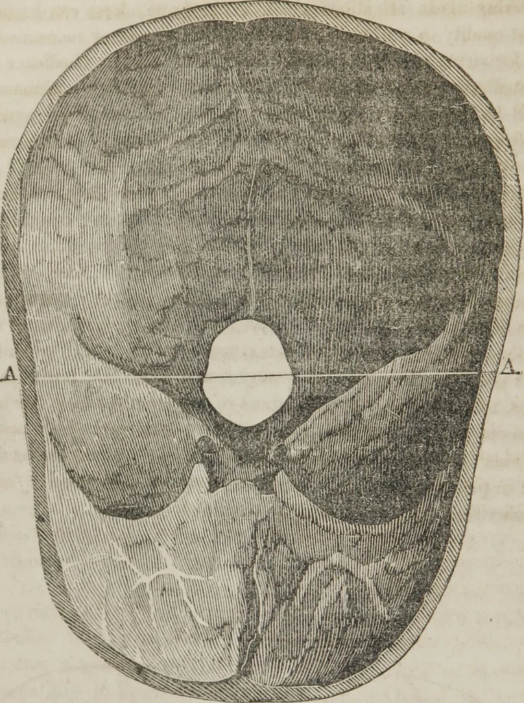 An illustration from Matrimony, or, Phrenology and physiology applied to the selection of congenial companions for life : including directions to the married for living together affectionately and happily, 1851, leaf 25