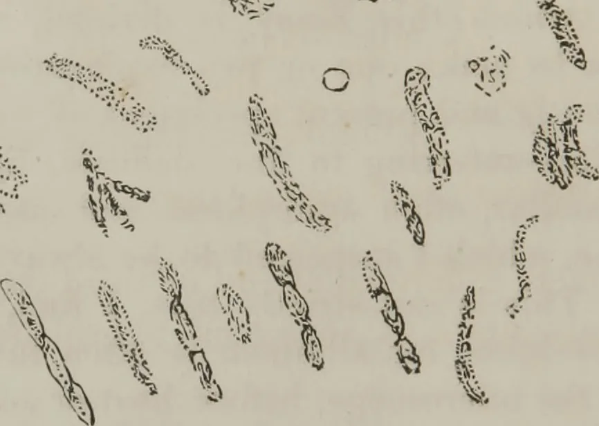 An illustration from Illustrations of disease with the microscope. clinical investigations, aided by the microscope, and by chemical reagents, with microscopical observations of pathological specimens, medical and surgical, obtained in Charleston, S.C. : a contribution intended to disclose the minute history of the diseases prevailing in this latitude, and to assist future students, 1861, leaf 101