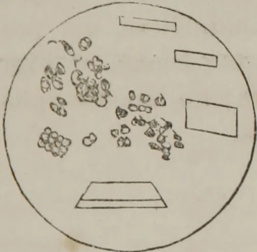 An illustration from Illustrations of disease with the microscope. clinical investigations, aided by the microscope, and by chemical reagents, with microscopical observations of pathological specimens, medical and surgical, obtained in Charleston, S.C. : a contribution intended to disclose the minute history of the diseases prevailing in this latitude, and to assist future students, 1861, leaf 102