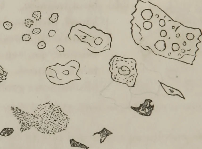 An illustration from Illustrations of disease with the microscope. clinical investigations, aided by the microscope, and by chemical reagents, with microscopical observations of pathological specimens, medical and surgical, obtained in Charleston, S.C. : a contribution intended to disclose the minute history of the diseases prevailing in this latitude, and to assist future students, 1861, leaf 103