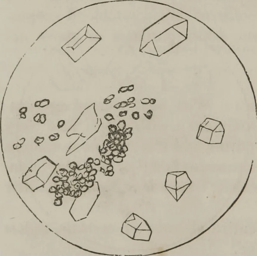 An illustration from Illustrations of disease with the microscope. clinical investigations, aided by the microscope, and by chemical reagents, with microscopical observations of pathological specimens, medical and surgical, obtained in Charleston, S.C. : a contribution intended to disclose the minute history of the diseases prevailing in this latitude, and to assist future students, 1861, leaf 105
