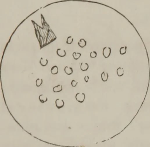 An illustration from Illustrations of disease with the microscope. clinical investigations, aided by the microscope, and by chemical reagents, with microscopical observations of pathological specimens, medical and surgical, obtained in Charleston, S.C. : a contribution intended to disclose the minute history of the diseases prevailing in this latitude, and to assist future students, 1861, leaf 106