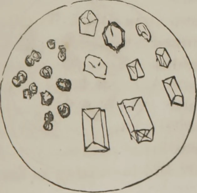 An illustration from Illustrations of disease with the microscope. clinical investigations, aided by the microscope, and by chemical reagents, with microscopical observations of pathological specimens, medical and surgical, obtained in Charleston, S.C. : a contribution intended to disclose the minute history of the diseases prevailing in this latitude, and to assist future students, 1861, leaf 106