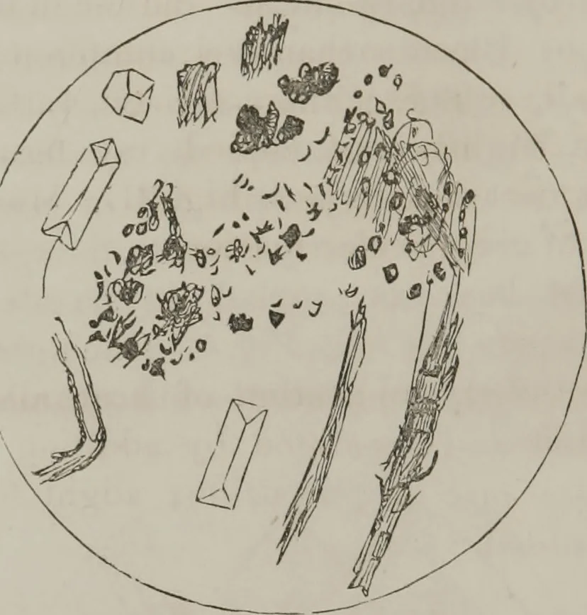 An illustration from Illustrations of disease with the microscope. clinical investigations, aided by the microscope, and by chemical reagents, with microscopical observations of pathological specimens, medical and surgical, obtained in Charleston, S.C. : a contribution intended to disclose the minute history of the diseases prevailing in this latitude, and to assist future students, 1861, leaf 107