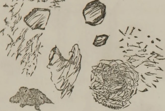 An illustration from Illustrations of disease with the microscope. clinical investigations, aided by the microscope, and by chemical reagents, with microscopical observations of pathological specimens, medical and surgical, obtained in Charleston, S.C. : a contribution intended to disclose the minute history of the diseases prevailing in this latitude, and to assist future students, 1861, leaf 108