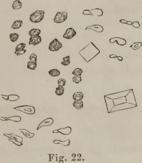 An illustration from Illustrations of disease with the microscope. clinical investigations, aided by the microscope, and by chemical reagents, with microscopical observations of pathological specimens, medical and surgical, obtained in Charleston, S.C. : a contribution intended to disclose the minute history of the diseases prevailing in this latitude, and to assist future students, 1861, leaf 108