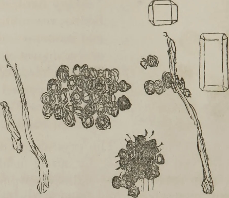 An illustration from Illustrations of disease with the microscope. clinical investigations, aided by the microscope, and by chemical reagents, with microscopical observations of pathological specimens, medical and surgical, obtained in Charleston, S.C. : a contribution intended to disclose the minute history of the diseases prevailing in this latitude, and to assist future students, 1861, leaf 109