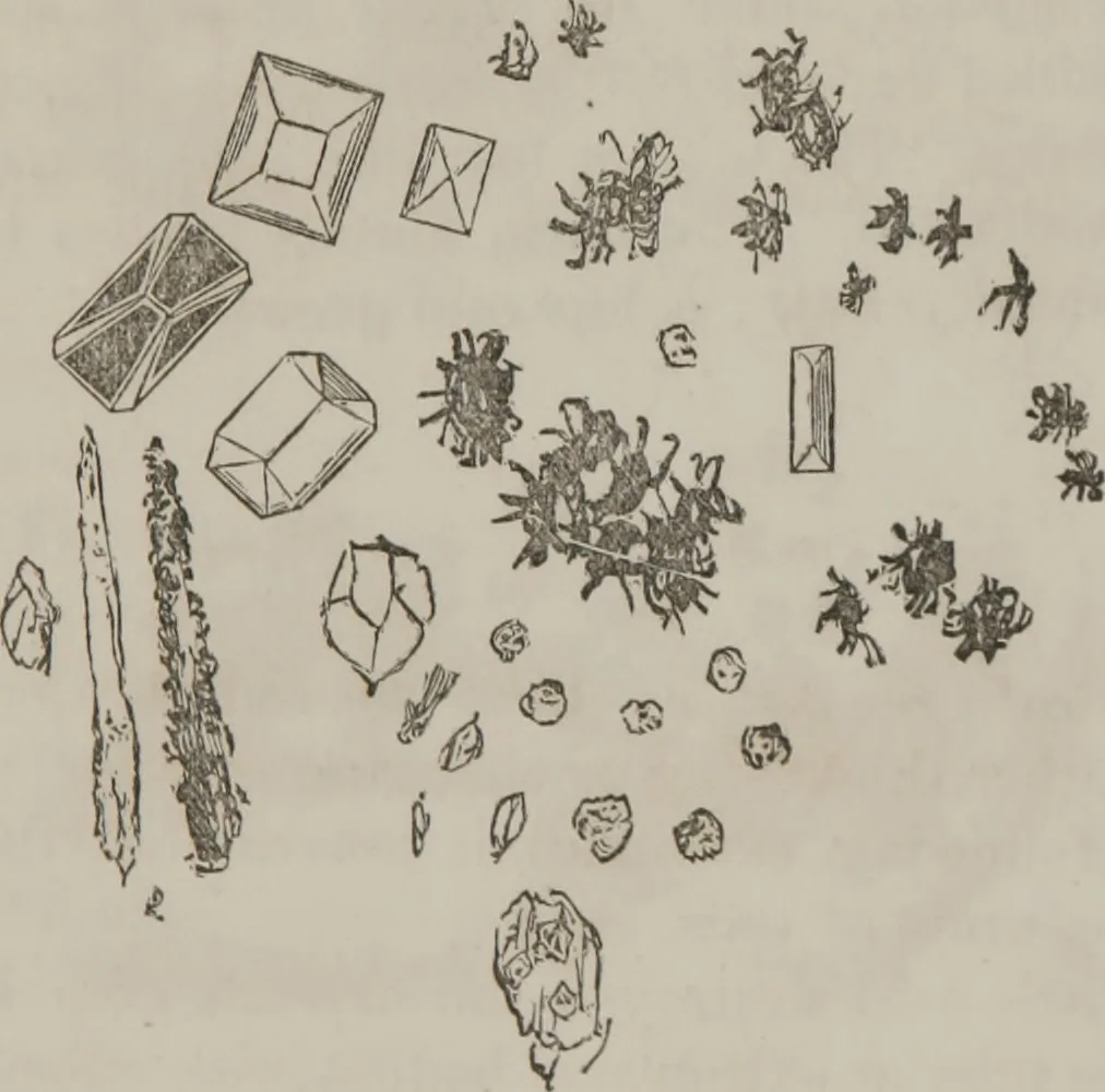 An illustration from Illustrations of disease with the microscope. clinical investigations, aided by the microscope, and by chemical reagents, with microscopical observations of pathological specimens, medical and surgical, obtained in Charleston, S.C. : a contribution intended to disclose the minute history of the diseases prevailing in this latitude, and to assist future students, 1861, leaf 110