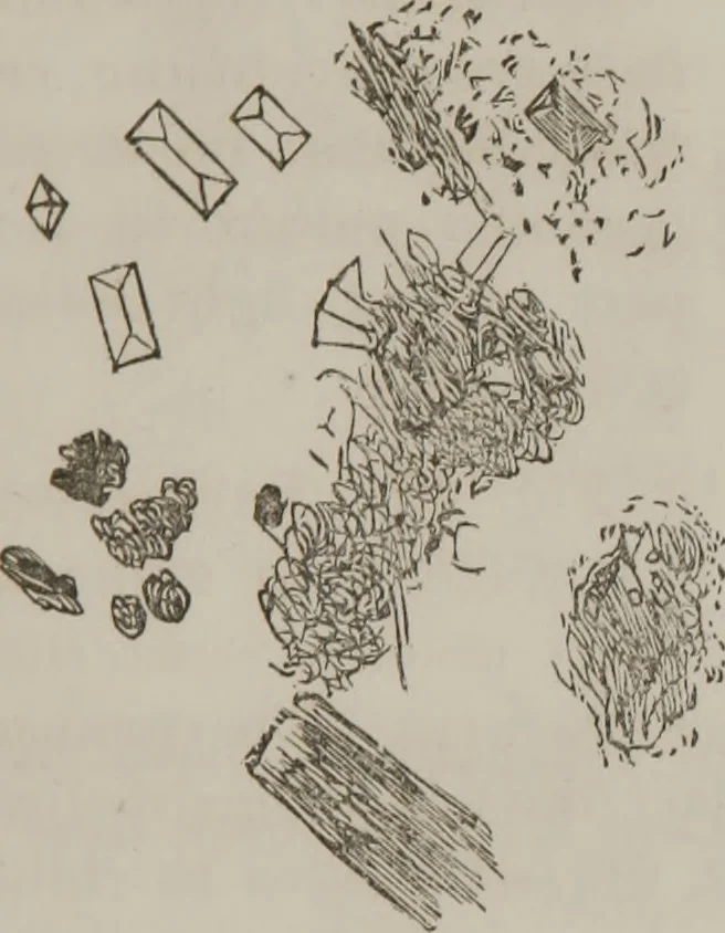 An illustration from Illustrations of disease with the microscope. clinical investigations, aided by the microscope, and by chemical reagents, with microscopical observations of pathological specimens, medical and surgical, obtained in Charleston, S.C. : a contribution intended to disclose the minute history of the diseases prevailing in this latitude, and to assist future students, 1861, leaf 112