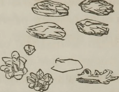 An illustration from Illustrations of disease with the microscope. clinical investigations, aided by the microscope, and by chemical reagents, with microscopical observations of pathological specimens, medical and surgical, obtained in Charleston, S.C. : a contribution intended to disclose the minute history of the diseases prevailing in this latitude, and to assist future students, 1861, leaf 115