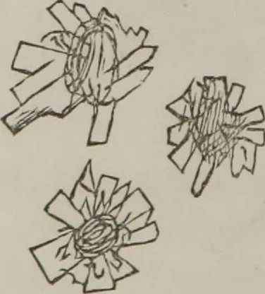 An illustration from Illustrations of disease with the microscope. clinical investigations, aided by the microscope, and by chemical reagents, with microscopical observations of pathological specimens, medical and surgical, obtained in Charleston, S.C. : a contribution intended to disclose the minute history of the diseases prevailing in this latitude, and to assist future students, 1861, leaf 119