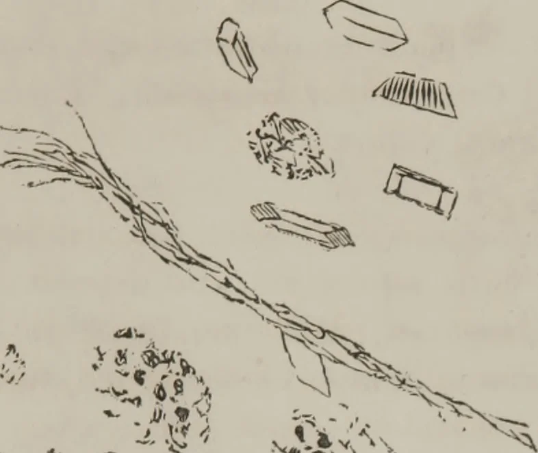 An illustration from Illustrations of disease with the microscope. clinical investigations, aided by the microscope, and by chemical reagents, with microscopical observations of pathological specimens, medical and surgical, obtained in Charleston, S.C. : a contribution intended to disclose the minute history of the diseases prevailing in this latitude, and to assist future students, 1861, leaf 120