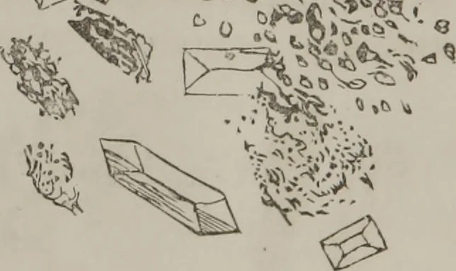 An illustration from Illustrations of disease with the microscope. clinical investigations, aided by the microscope, and by chemical reagents, with microscopical observations of pathological specimens, medical and surgical, obtained in Charleston, S.C. : a contribution intended to disclose the minute history of the diseases prevailing in this latitude, and to assist future students, 1861, leaf 121