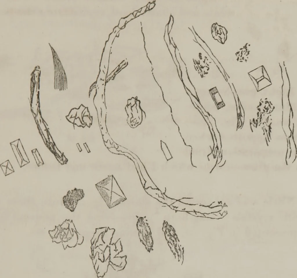 An illustration from Illustrations of disease with the microscope. clinical investigations, aided by the microscope, and by chemical reagents, with microscopical observations of pathological specimens, medical and surgical, obtained in Charleston, S.C. : a contribution intended to disclose the minute history of the diseases prevailing in this latitude, and to assist future students, 1861, leaf 122