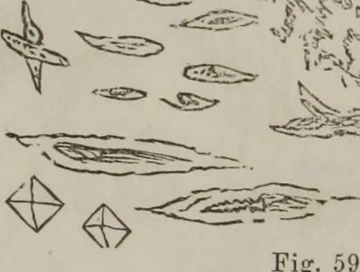 An illustration from Illustrations of disease with the microscope. clinical investigations, aided by the microscope, and by chemical reagents, with microscopical observations of pathological specimens, medical and surgical, obtained in Charleston, S.C. : a contribution intended to disclose the minute history of the diseases prevailing in this latitude, and to assist future students, 1861, leaf 123
