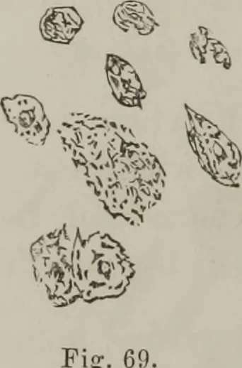 An illustration from Illustrations of disease with the microscope. clinical investigations, aided by the microscope, and by chemical reagents, with microscopical observations of pathological specimens, medical and surgical, obtained in Charleston, S.C. : a contribution intended to disclose the minute history of the diseases prevailing in this latitude, and to assist future students, 1861, leaf 127