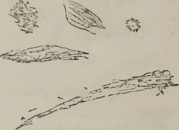 An illustration from Illustrations of disease with the microscope. clinical investigations, aided by the microscope, and by chemical reagents, with microscopical observations of pathological specimens, medical and surgical, obtained in Charleston, S.C. : a contribution intended to disclose the minute history of the diseases prevailing in this latitude, and to assist future students, 1861, leaf 131