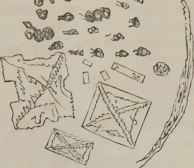 An illustration from Illustrations of disease with the microscope. clinical investigations, aided by the microscope, and by chemical reagents, with microscopical observations of pathological specimens, medical and surgical, obtained in Charleston, S.C. : a contribution intended to disclose the minute history of the diseases prevailing in this latitude, and to assist future students, 1861, leaf 132
