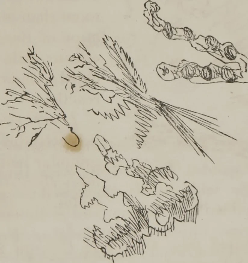 An illustration from Illustrations of disease with the microscope. clinical investigations, aided by the microscope, and by chemical reagents, with microscopical observations of pathological specimens, medical and surgical, obtained in Charleston, S.C. : a contribution intended to disclose the minute history of the diseases prevailing in this latitude, and to assist future students, 1861, leaf 132