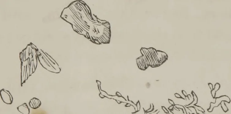 An illustration from Illustrations of disease with the microscope. clinical investigations, aided by the microscope, and by chemical reagents, with microscopical observations of pathological specimens, medical and surgical, obtained in Charleston, S.C. : a contribution intended to disclose the minute history of the diseases prevailing in this latitude, and to assist future students, 1861, leaf 134