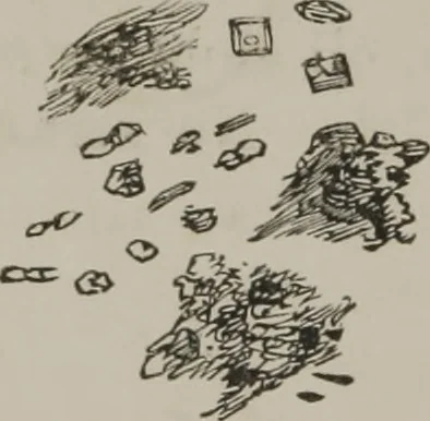 An illustration from Illustrations of disease with the microscope. clinical investigations, aided by the microscope, and by chemical reagents, with microscopical observations of pathological specimens, medical and surgical, obtained in Charleston, S.C. : a contribution intended to disclose the minute history of the diseases prevailing in this latitude, and to assist future students, 1861, leaf 139