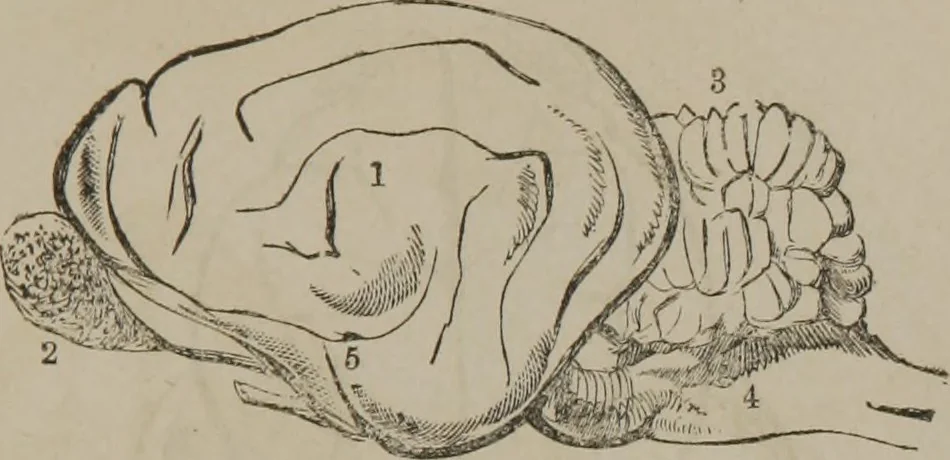 An illustration from The mysteries of human nature explained by a new system of nervous physiology : to which is added, a review of the errors of spiritualism, and instructions for developing or resisting the influence by which subjects and mediums are made, 1857, leaf 148