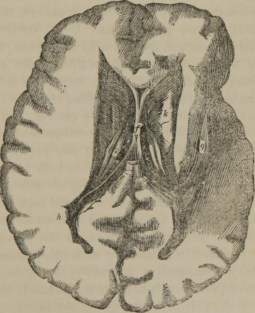An illustration from The mysteries of human nature explained by a new system of nervous physiology : to which is added, a review of the errors of spiritualism, and instructions for developing or resisting the influence by which subjects and mediums are made, 1857, leaf 160