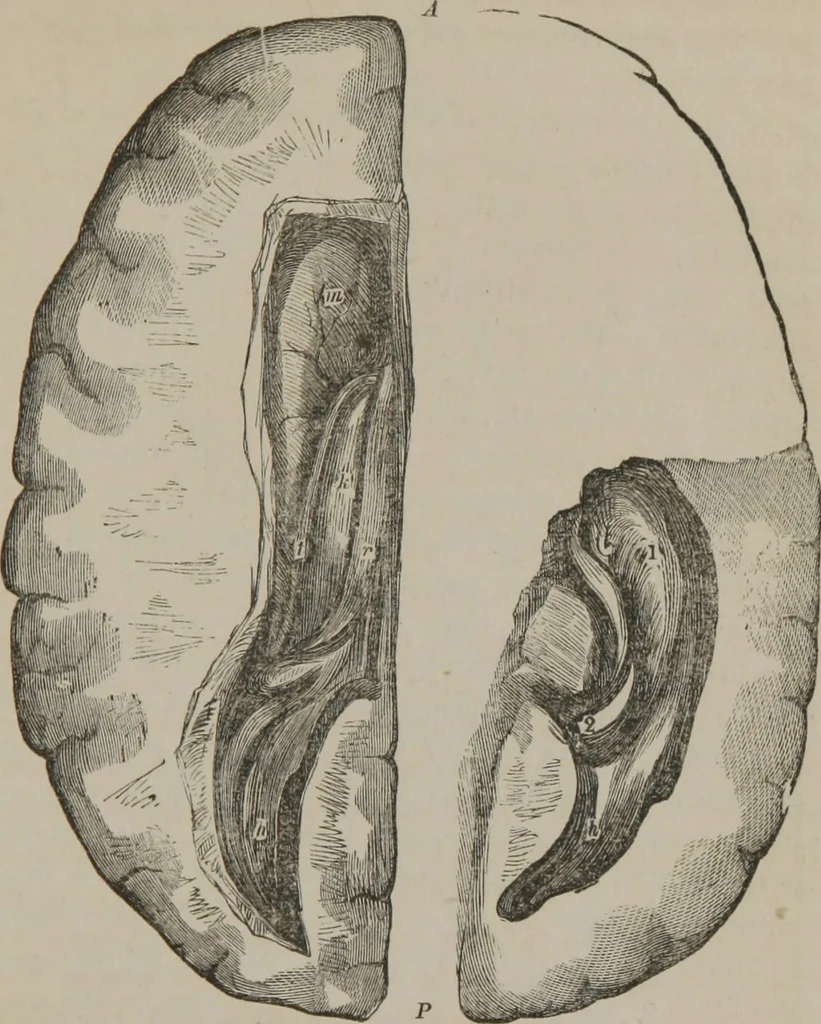 An illustration from The mysteries of human nature explained by a new system of nervous physiology : to which is added, a review of the errors of spiritualism, and instructions for developing or resisting the influence by which subjects and mediums are made, 1857, leaf 196