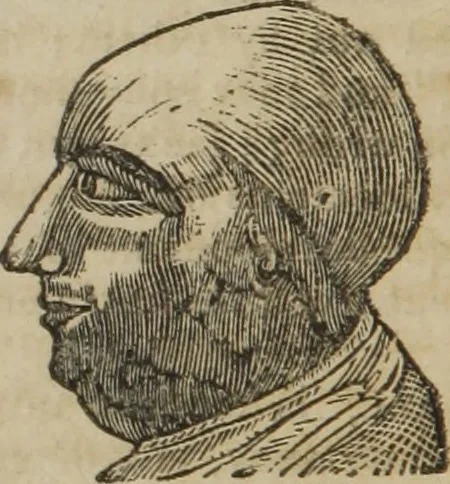 An illustration from A guide to phrenology : designed to illustrate the science of the human mind as manifested through the brain : embracing the fundamental principles of phrenology : its utility to parents and teachers in developing and educating the mental faculties of the rising generation, and of self improvement : together with the adaptation of each of the organs and a phrenological chart, in seven degrees of development with numerous combinations, 1842, leaf 105