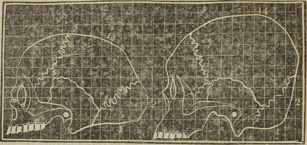 An illustration from A guide to phrenology : designed to illustrate the science of the human mind as manifested through the brain : embracing the fundamental principles of phrenology : its utility to parents and teachers in developing and educating the mental faculties of the rising generation, and of self improvement : together with the adaptation of each of the organs and a phrenological chart, in seven degrees of development with numerous combinations, 1842, leaf 57