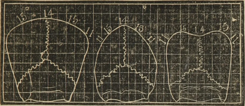 An illustration from A guide to phrenology : designed to illustrate the science of the human mind as manifested through the brain : embracing the fundamental principles of phrenology : its utility to parents and teachers in developing and educating the mental faculties of the rising generation, and of self improvement : together with the adaptation of each of the organs and a phrenological chart, in seven degrees of development with numerous combinations, 1842, leaf 88